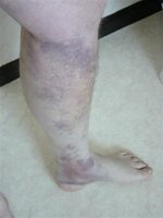 leg (small).jpg