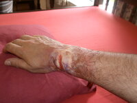 injury1.JPG