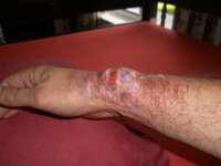 injury2.JPG