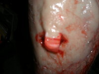 injury3.JPG