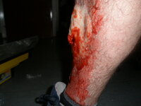 injury5.JPG
