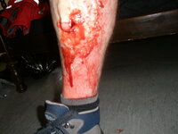 injury6.JPG