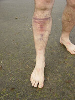 leg2.jpg