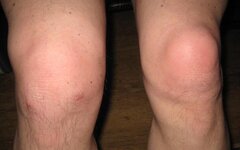 Copy of Knees 11.12.2011.jpg