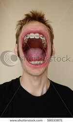 stock-photo-a-huge-screaming-mouth-with-braces-on-his-teeth-yelling-his-face-off-58533871.jpg