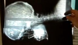 Jaw pic.jpg