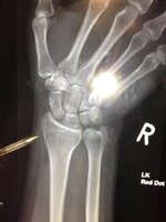 X-Ray 1.jpg