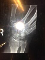 X-Ray 2.jpg