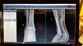 20151225_151839.jpg