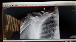 20151225_153649.jpg
