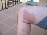 knee (Small).JPG