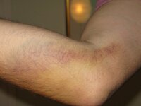 elbow from falloffathon.jpg