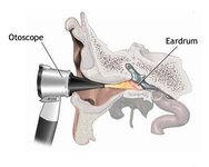 otoscope.jpg
