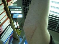 elbow.JPG