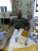 Andy leg.jpg