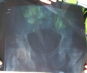 xray.jpg